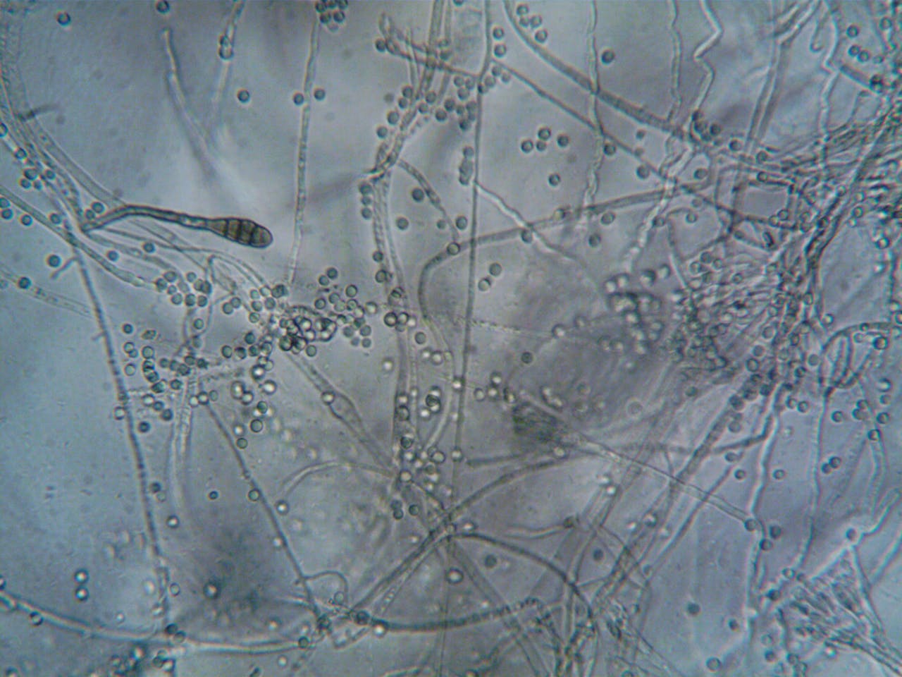 home-img Detailed microscopic view showing fungal hyphae and spores, ideal for biology and microbiology themes.